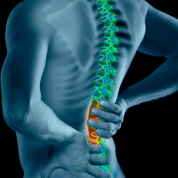 procarelowerbackinjuryfortlauderdale