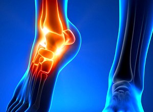 procare-services-ankle-injuriesa