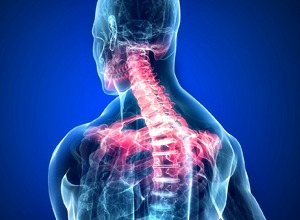 procare-services-gait-disordersa