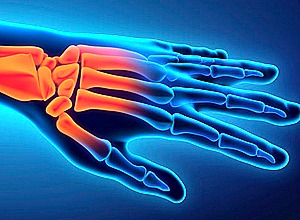 procare-services-hand-injuriesa