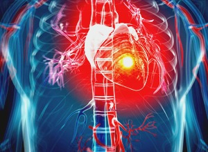 procare-services-heart-attackas
