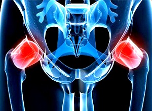 procare-services-hip-paina