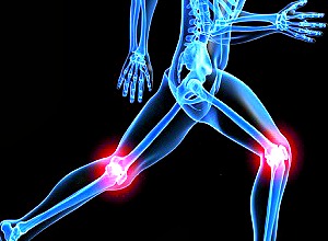 procare-services-knee-injuriesa