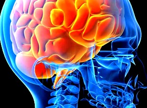 procare-services-neurological-disordersa