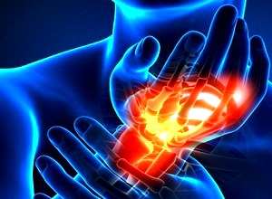 procare-services-wrist-injuriesA